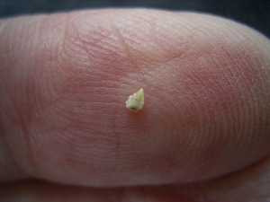 Cynodont tooth # 2 - early mammal-like reptile