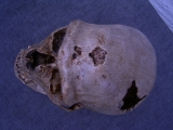 Neanderthalerschädel von La Chapelle