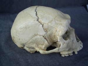 (6) Reconstruction complete skull of Arago XXI