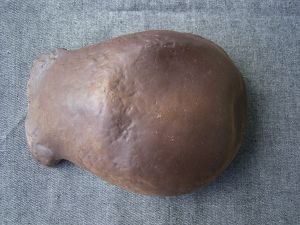 Homo Erectus Skull Cap Trinil II